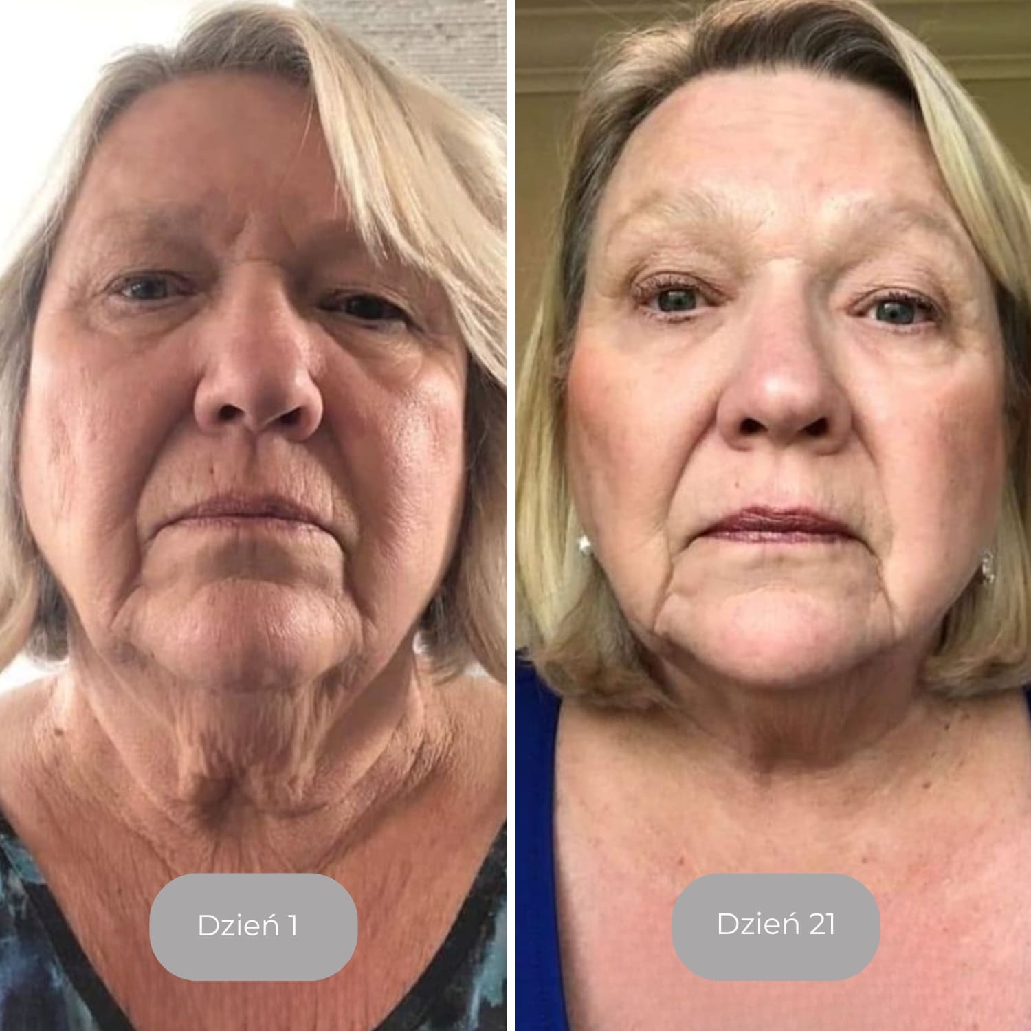 Luminate – Serum do twarzy z witaminą C