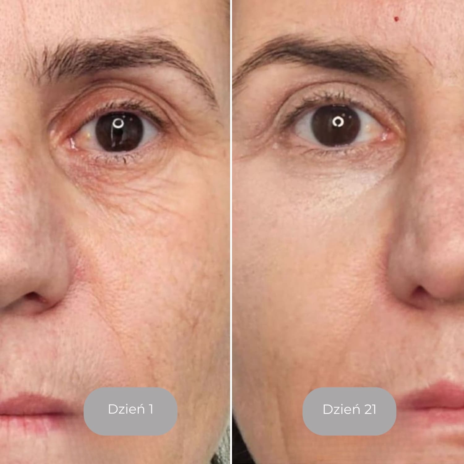 Luminate – Serum do twarzy z witaminą C